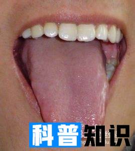 舌苔呈现的颜色分别表征什么症状？
